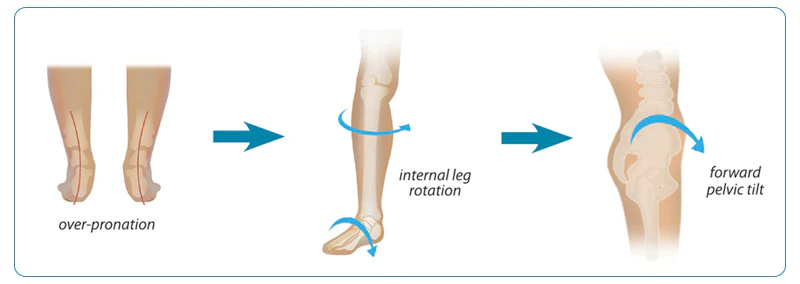 External leg online rotation